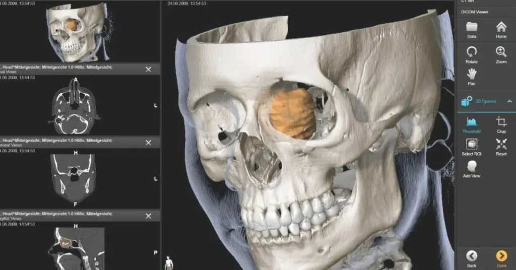 DICOM Viewer?